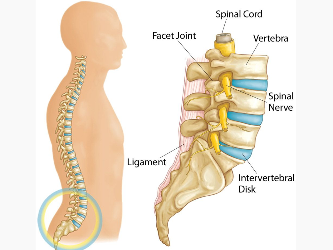 Rupture Disk And Spinal Stenosis