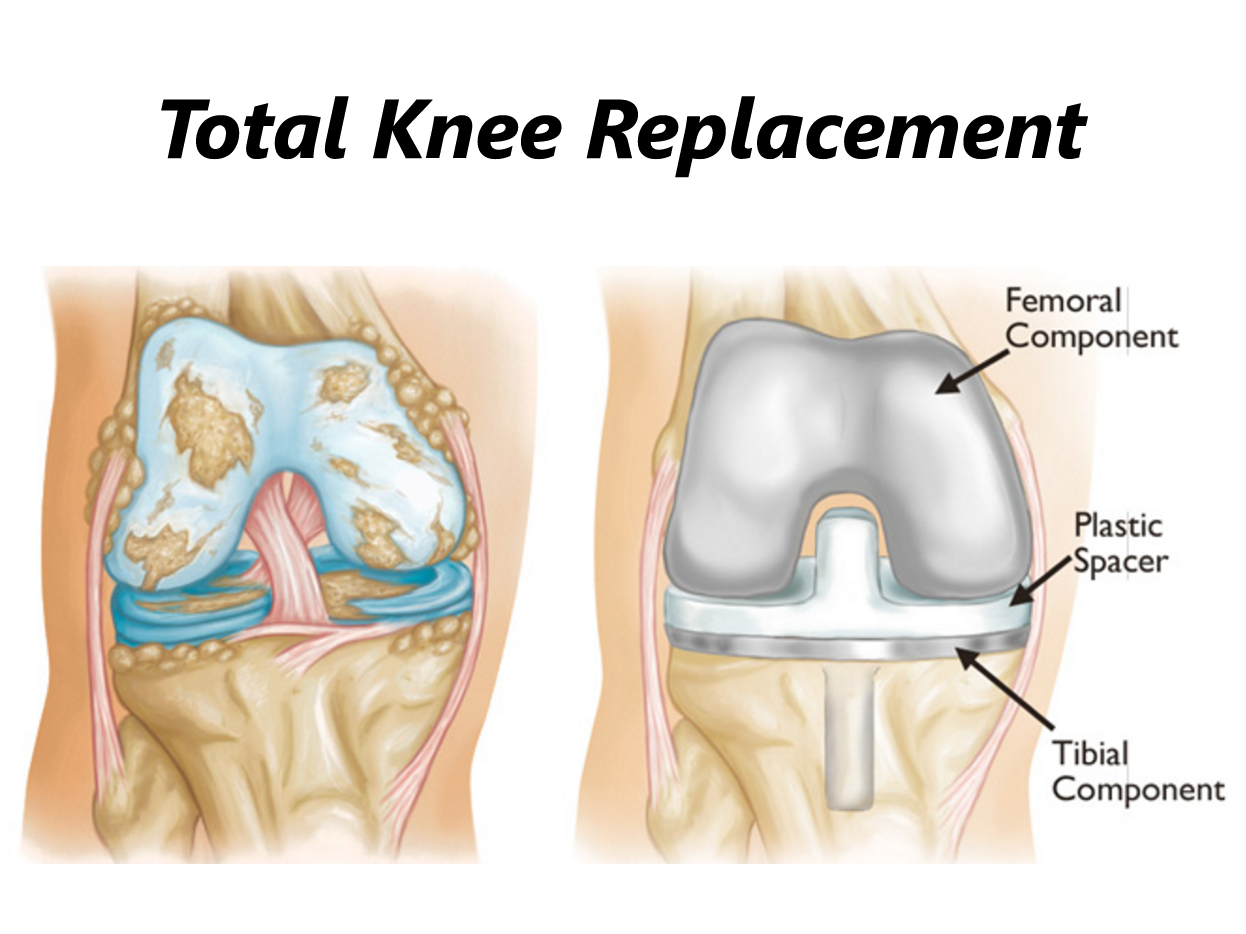 Orthopedic